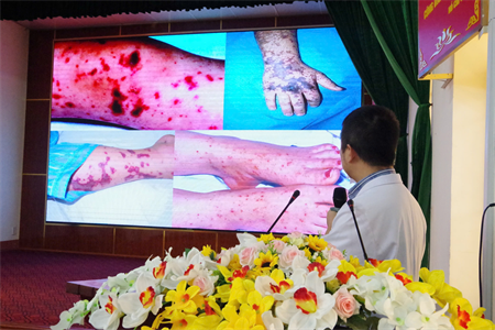 Bệnh viện Quân y 7B tập huấn giám sát, chẩn đoán, điều trị và phòng, chống dịch bệnh do não mô cầu